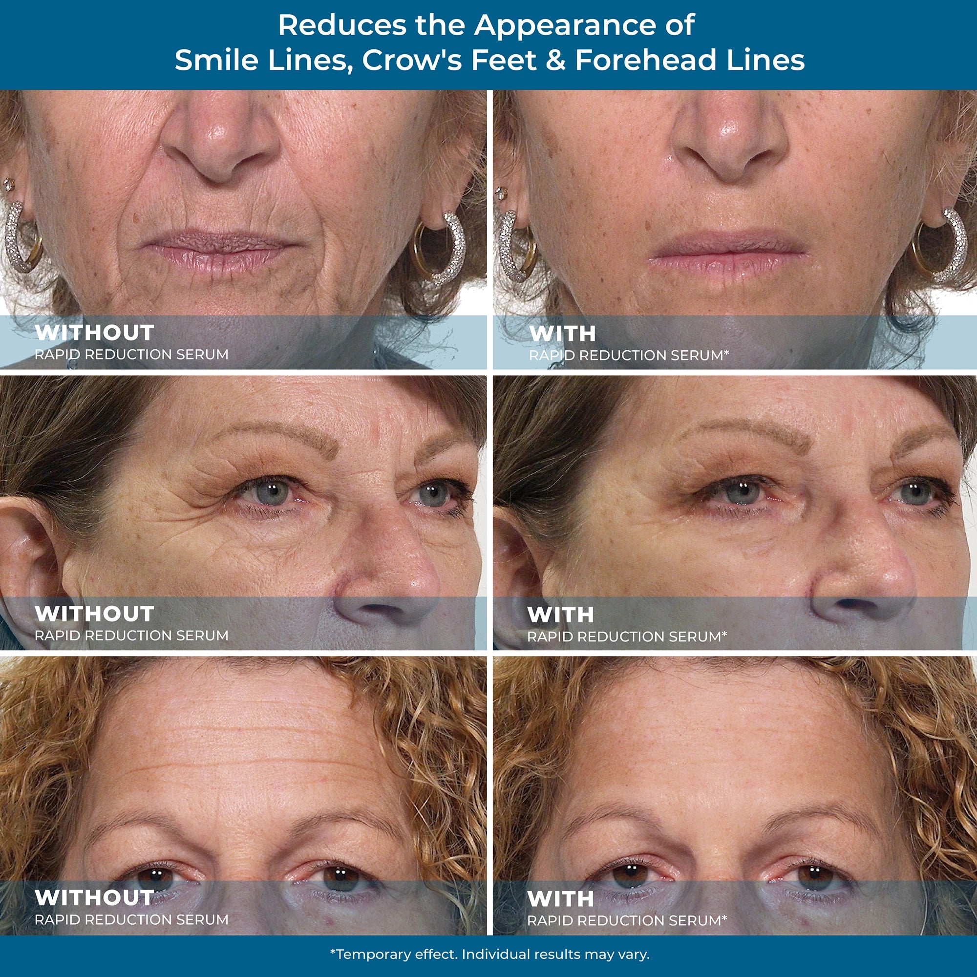 Plexaderm Rapid Reduction Serum — Instantly and visibly diminishes under-eye bags, wrinkles, dark circles, fine lines, and crow's feet; full-size product.